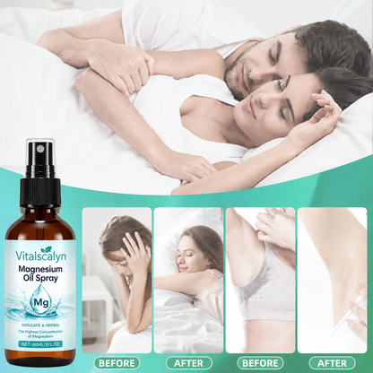 💤Vitalscalyn™ Pure Magnesium Oil Spray